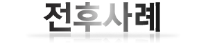 전후사례